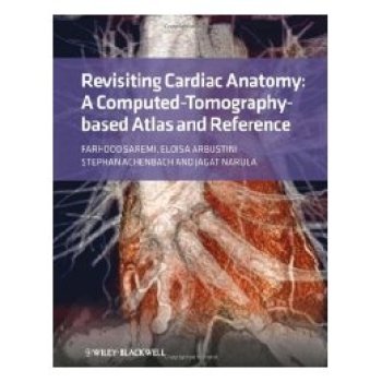 【预订】Revisiting Cardiac Anatomy - a Computed-Tomography- Based Atlas and Reference