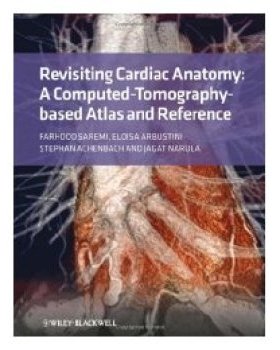 【预订】Revisiting Cardiac Anatomy - a Computed-Tomography- Based Atlas and Reference