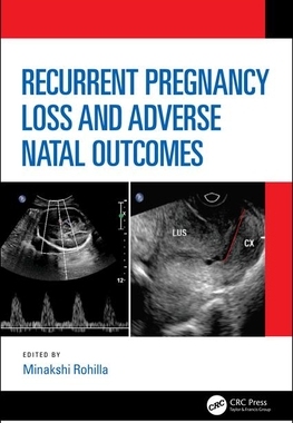 【预订】Recurrent Pregnancy Loss and Adverse Natal Outcomes