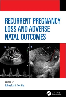 【预订】Recurrent Pregnancy Loss and Adverse Natal Outcomes