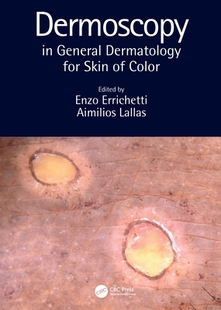 【预订】Dermoscopy in General Dermatology for Skin of Color 9780367418403