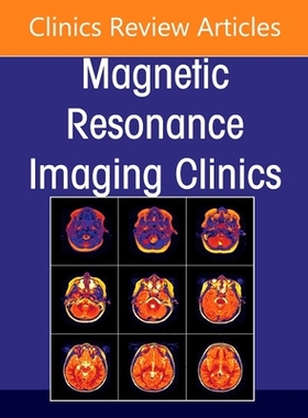 【预订】Advances in Diffusion-Weighted Imaging, an Issue of Magnetic Resonance Imaging Clinics of North America, 29