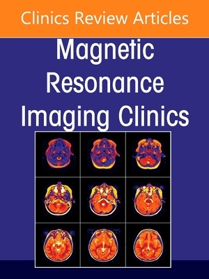 【预订】Advances in Diffusion-Weighted Imaging, an Issue of Magnetic Resonance Imaging Clinics of North America, 29