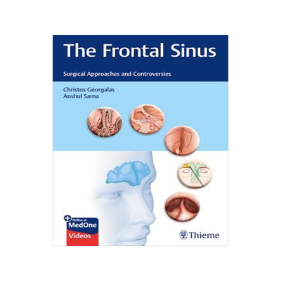 [预订]The Frontal Sinus 9783132400528