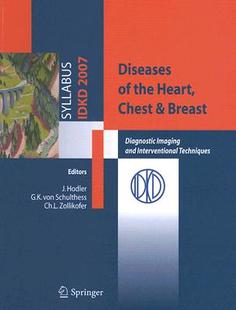 the Heart Diseases Chest Breast 预订