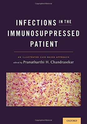 【预订】Infections in the Immunosuppressed Patient