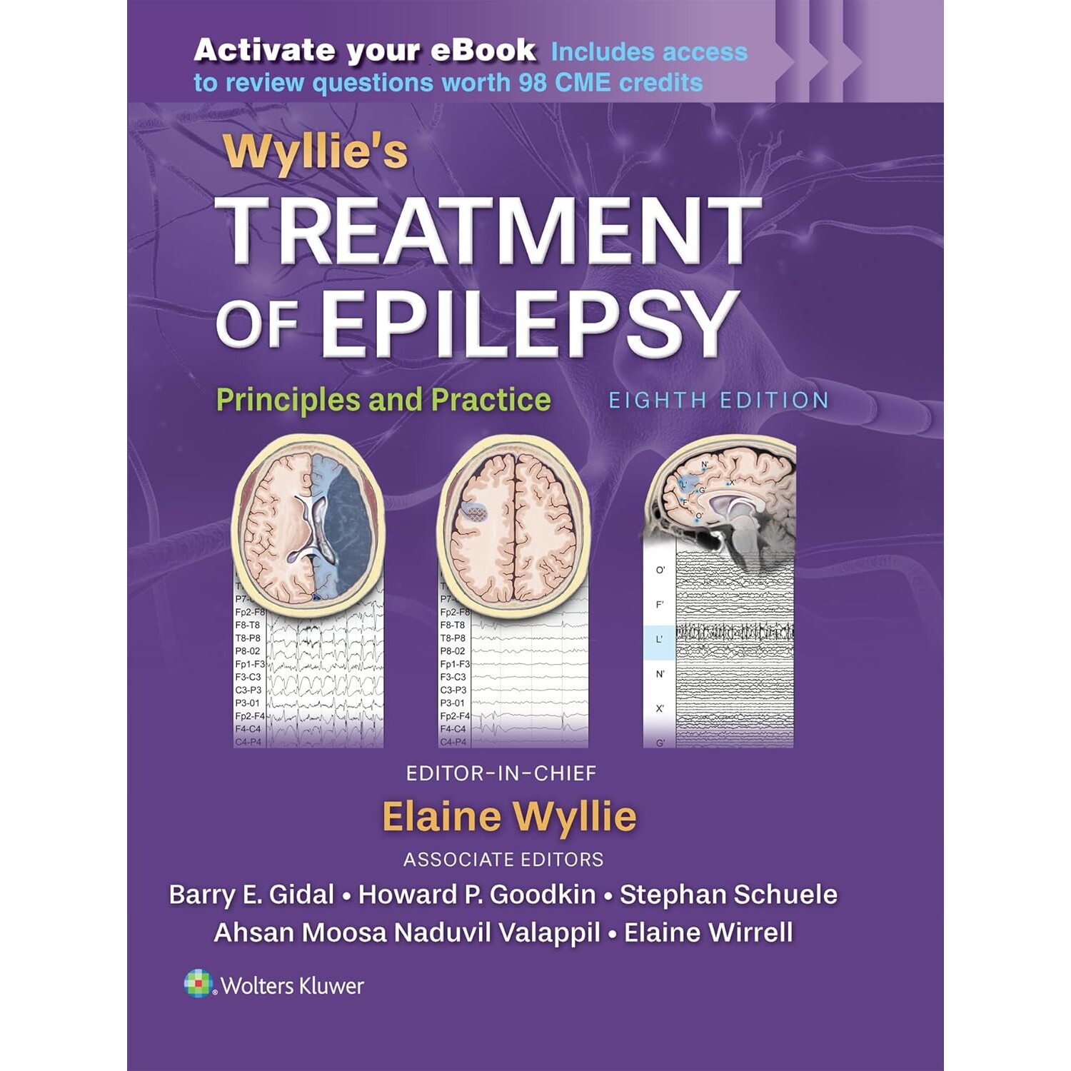预订 Wyllie’s Treatment of Epilepsy Print + eBook with Multimedia: Principles and Practice 威利的癫痫治疗:纸质版+电子