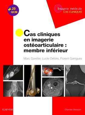 预订 Cas cliniques en imagerie ostéoarticulaire : membre inférieur 骨关节成像临床病例：下肢: 9782294759666