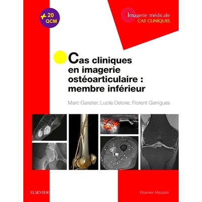 预订 Cas cliniques en imagerie ostéoarticulaire : membre inférieur 骨关节成像临床病例：下肢: 9782294759666