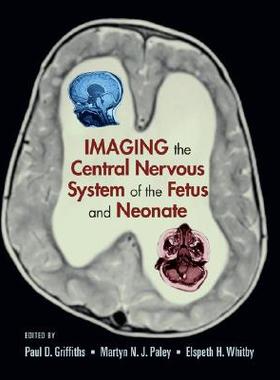 【预订】Imaging the Central Nervous System of the Fetus and Neonate