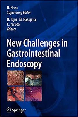 【预订】New Challenges in Gastrointestinal Endoscopy