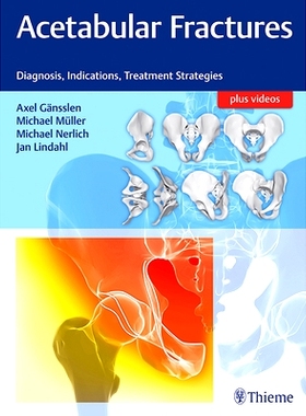 预订 Acetabular Fractures: Diagnosis, Indications, Treatment Strategies 髋臼骨折: 9783132415607