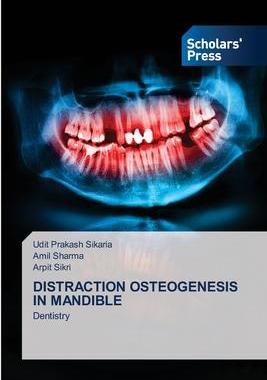 [预订]Distraction Osteogenesis in Mandible 9786138947448