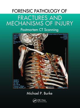 【预订】Forensic Pathology of Fractures and Mechanisms of Injury 9780367778194