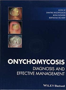 【预售】Onychomycosis: Diagnosis And Effecti...