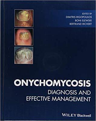 【预售】Onychomycosis: Diagnosis And Effecti...