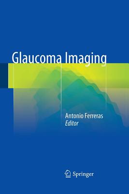 【预订】Glaucoma Imaging