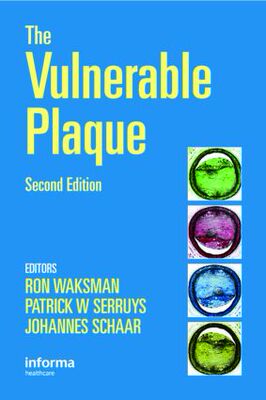 【预订】Handbook of the Vulnerable Plaque