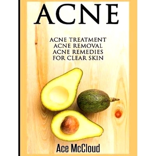 预订 Acne: Acne Treatment: Acne Removal: Acne Remedies For Clear Skin: 9781640483767