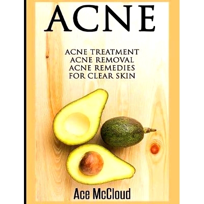 预订 Acne: Acne Treatment: Acne Removal: Acne Remedies For Clear Skin: 9781640483767