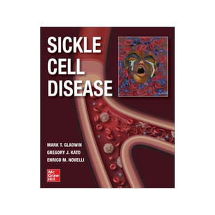 [预订]Sickle Cell Disease 9781260458596
