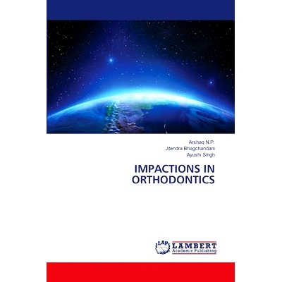 预订 Impactions in Orthodontics: 9786207999378