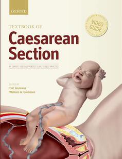 【预订】Textbook of Caesarean Section