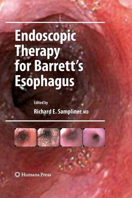 【预订】Endoscopic Therapy for Barrett’s Esophagus