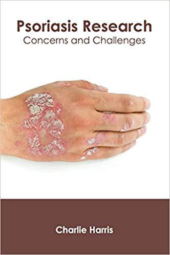 【预售】Psoriasis Research: Concerns and Challenges
