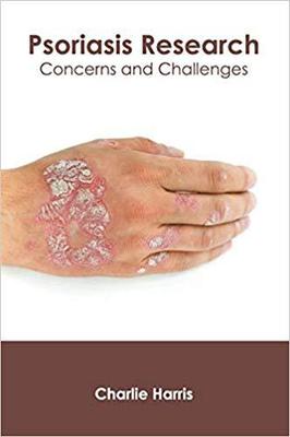 【预售】Psoriasis Research: Concerns and Challenges