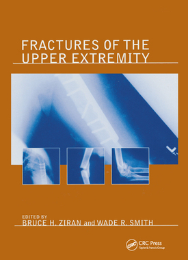 【预订】Fractures of the Upper Extremity
