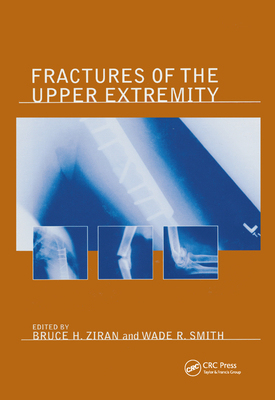 【预订】Fractures of the Upper Extremity