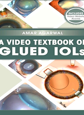 预订 A Video Textbook of Glued IOLs 胶合人工晶状体视频教材: 9781630912246