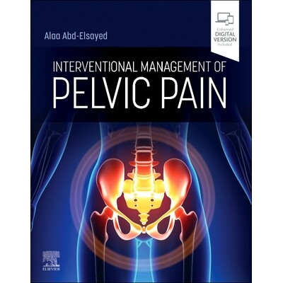预订 Interventional Management of Pelvic Pain 盆腔疼痛的介入治疗: 9780443121050