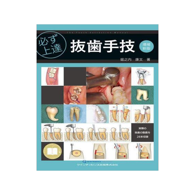 [预订]必ず上達抜歯手技 増補新版 9784781208817