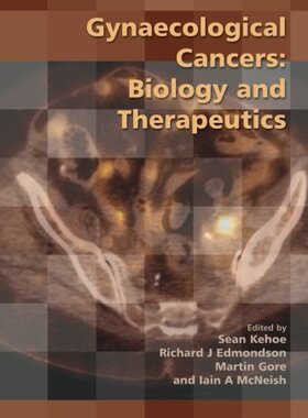 【预订】Gynaecological Cancers