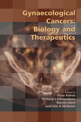 【预订】Gynaecological Cancers