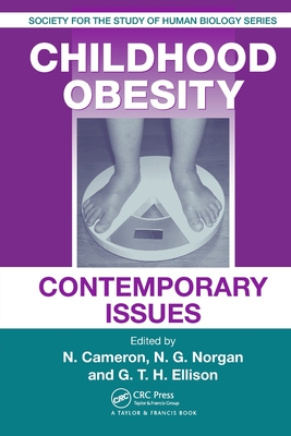 【预订】Childhood Obesity: Contemporary Issues