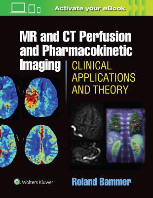 【预订】MR and CT Perfusion and Pharmacokinetic Imaging