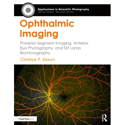 Posterior Segment Imaging, Anterior Eye