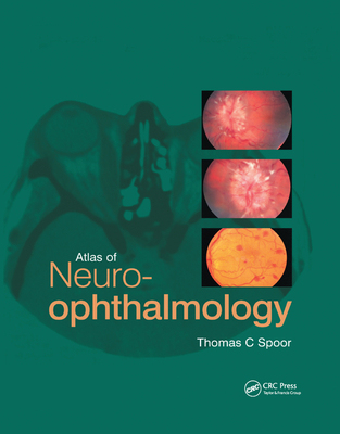【预订】Atlas of Neuro-ophthalmology