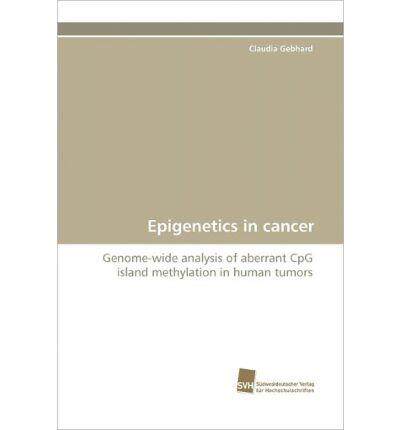 [预订]Epigenetics in cancer 9783838120706