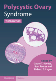 【预订】Polycystic Ovary Syndrome 9781108839334