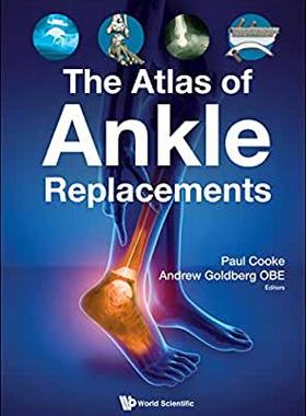 【预订】The Atlas of Ankle Replacements
