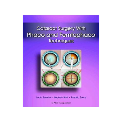 预订 Cataract Surgery With Phaco & Femtophaco Techniques