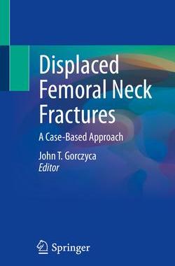 [预订]Displaced Femoral Neck Fractures 9783030844431