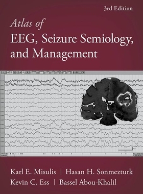 【预订】Atlas of EEG, Seizure Semiology, and Management 9780197543023