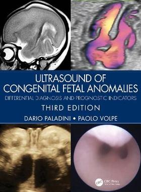 预订 Ultrasound of Congenital Fetal Anomalies: Differential Diagnosis and Prognostic Indicators