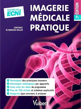 预订 Imagerie médicale pratique : du DFGSM2 aux ECNi 实用医学成像：从 DFGSM2 到 ECNi: 9782311660708