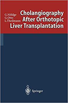 【预订】Cholangiography After Orthotopic Liver Transplantation
